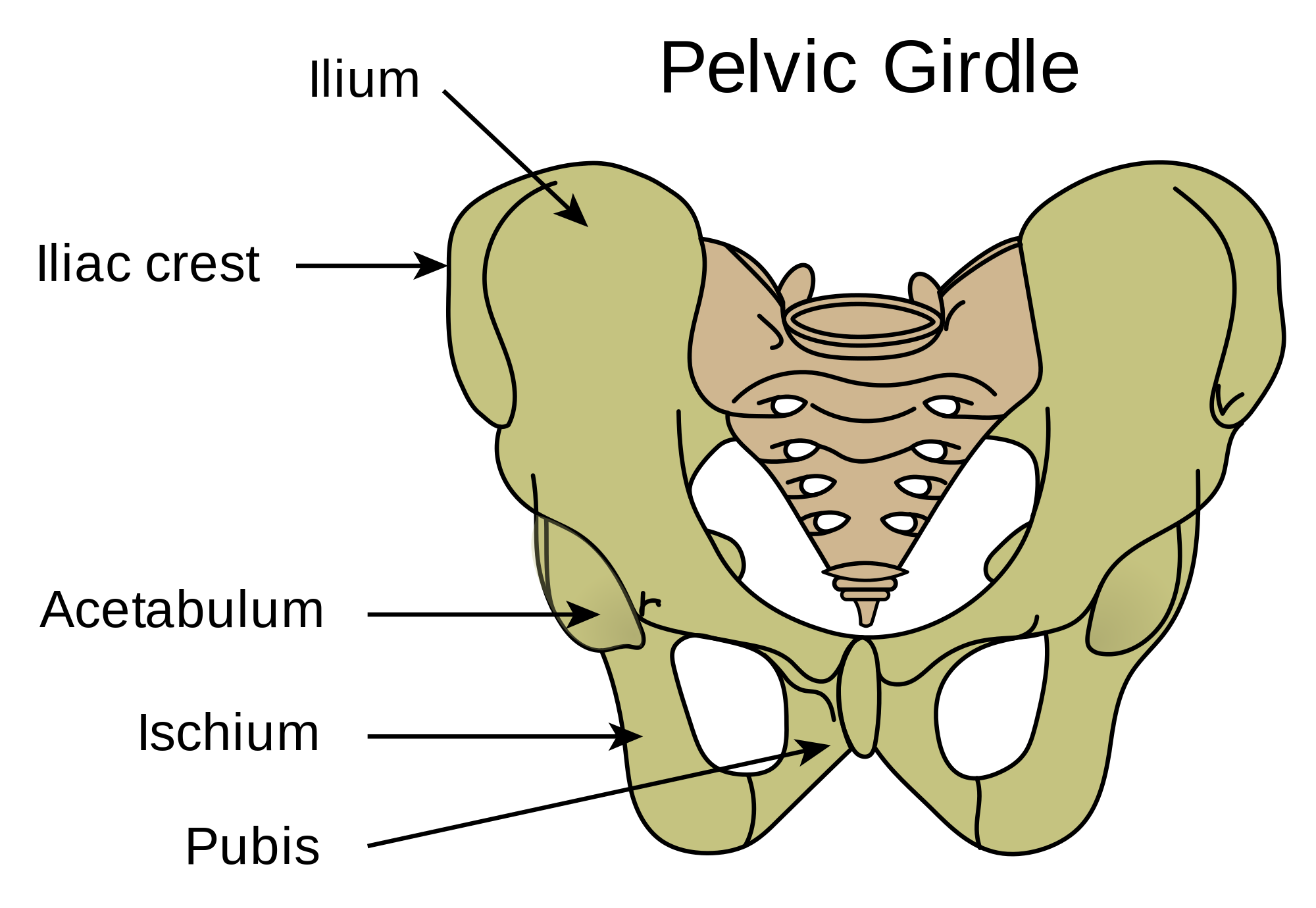 Descripción: Clinical examination revealed 7-mm probing depths, circumferentially around a mandibular implant, bleeding on probing, and the presence of exudate and gingival inflammatory edema