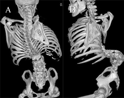 Descripción: Clinical examination revealed 7-mm probing depths, circumferentially around a mandibular implant, bleeding on probing, and the presence of exudate and gingival inflammatory edema