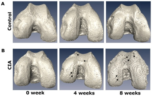 Descripción: Clinical examination revealed 7-mm probing depths, circumferentially around a mandibular implant, bleeding on probing, and the presence of exudate and gingival inflammatory edema